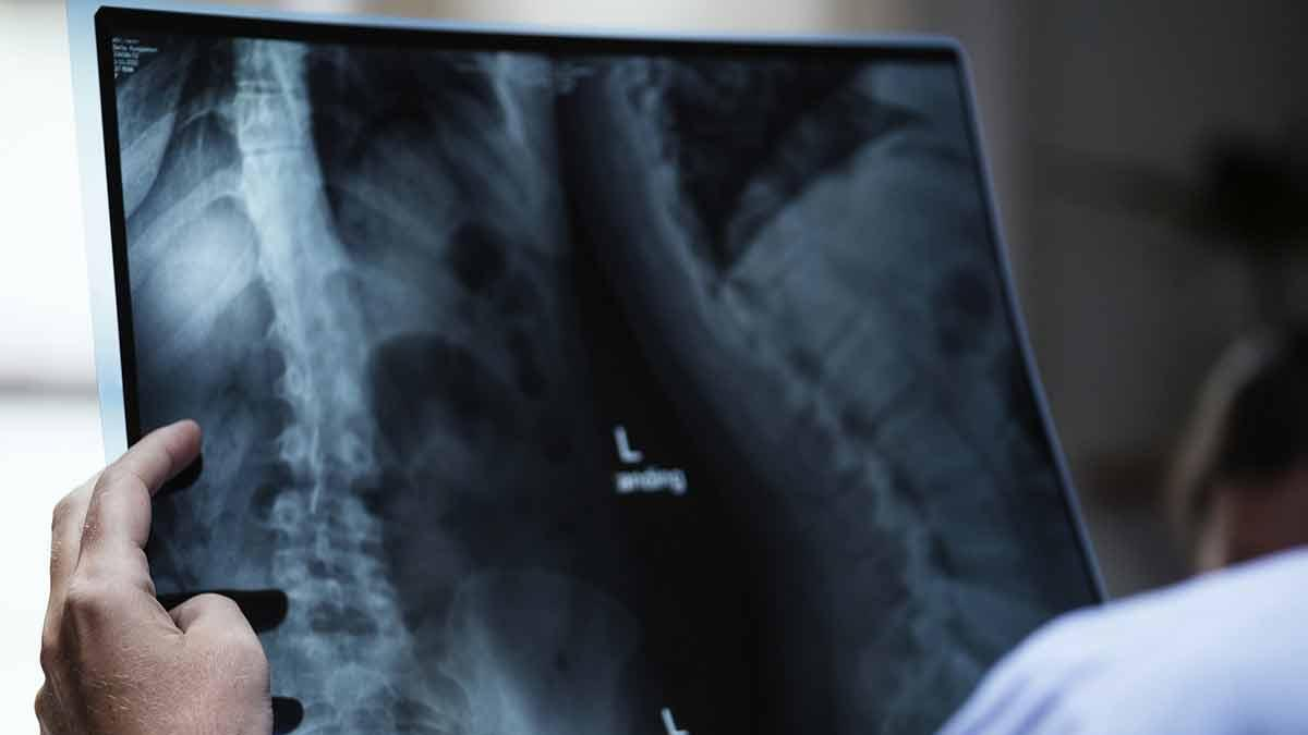 Urgen a hombres a revisar su próstata desde los 38 años para prevenir complicaciones urinarias